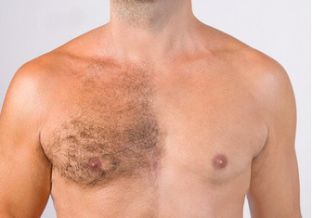 epilation du torse chez l'homme