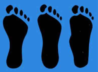 pieds plats
