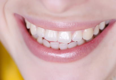 Mon dentiste : clinique dentaire LaSalle