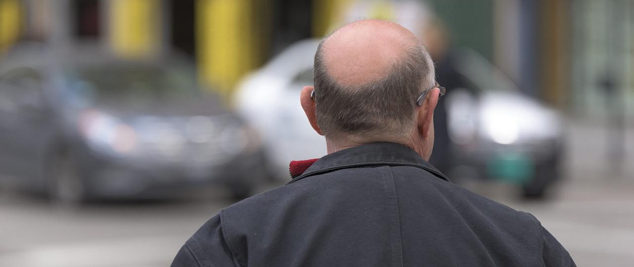 Docteur Pascal Boudjema : greffe capillaire à Paris