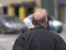 Docteur Pascal Boudjema : greffe capillaire à Paris